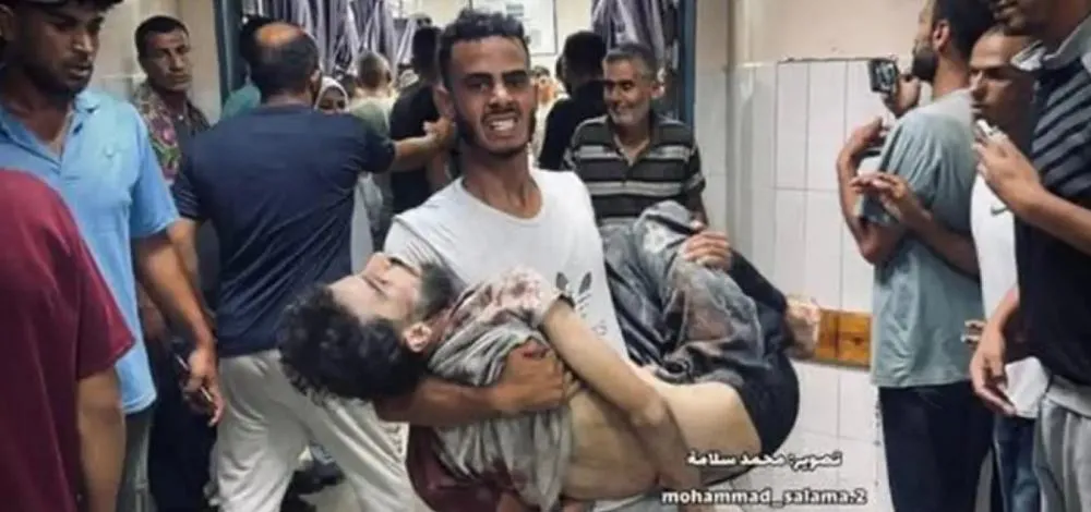 Crise humanitária em Gaza: fome e desnutrição matam mais cinco pessoas, total chega a 127