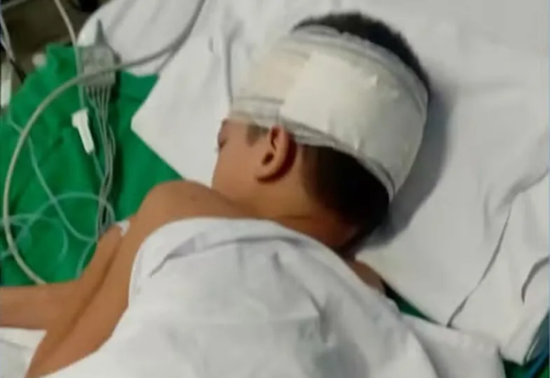 Criança de 7 anos leva choque em poste energizado em praça de São Luís