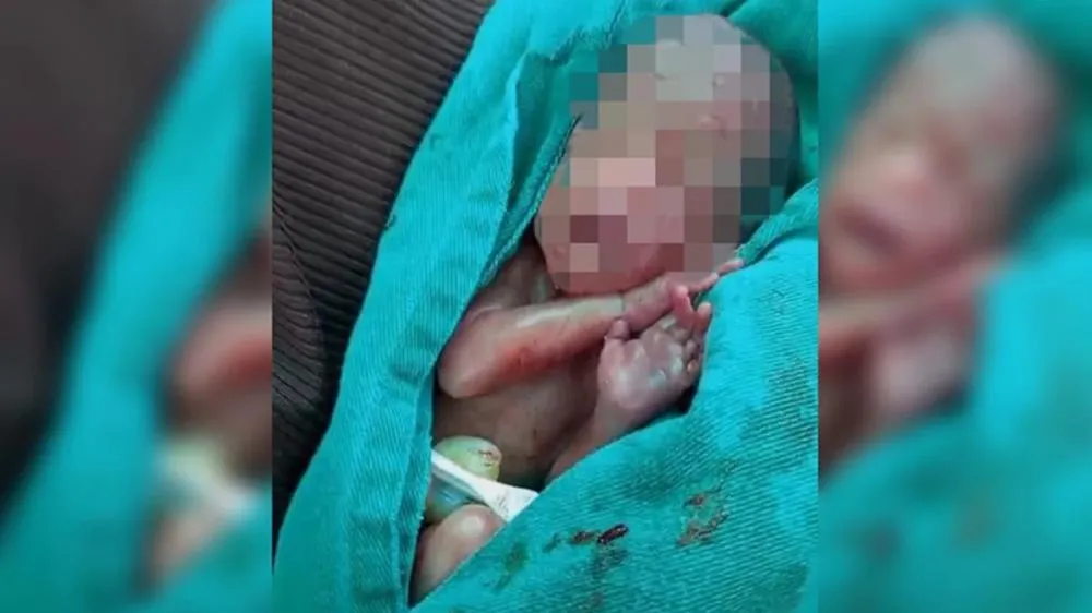 Bebê era dado como morto, chora em velório e morre na UTI neonatal