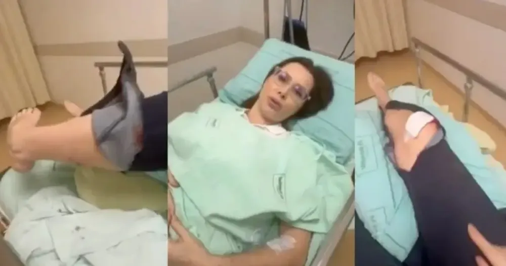 Deputada Carol de Toni fratura o joelho após cair ao fugir de cachorro em Santa Catarina