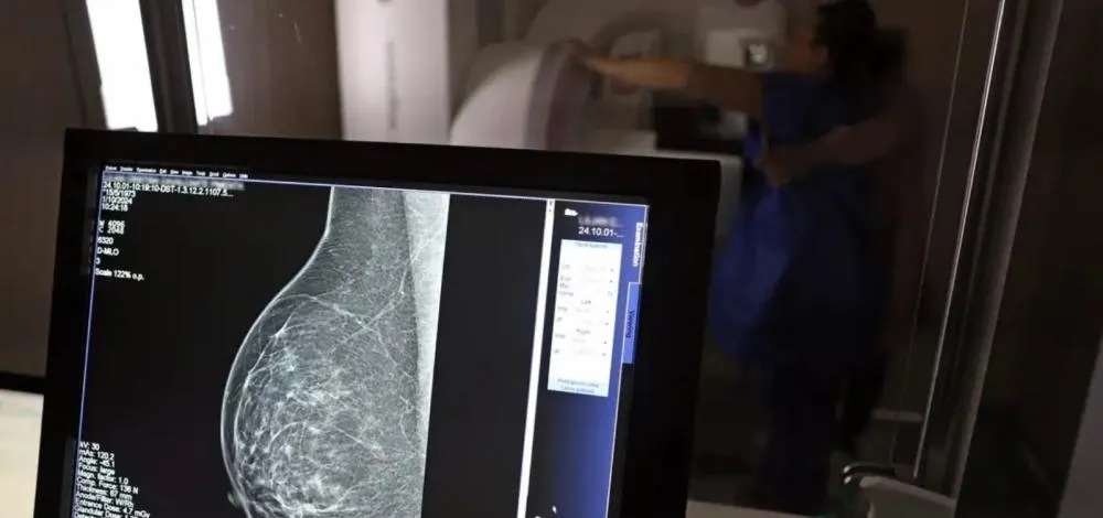 SUS vai oferecer teste genético para detectar mutações ligadas ao câncer de mama