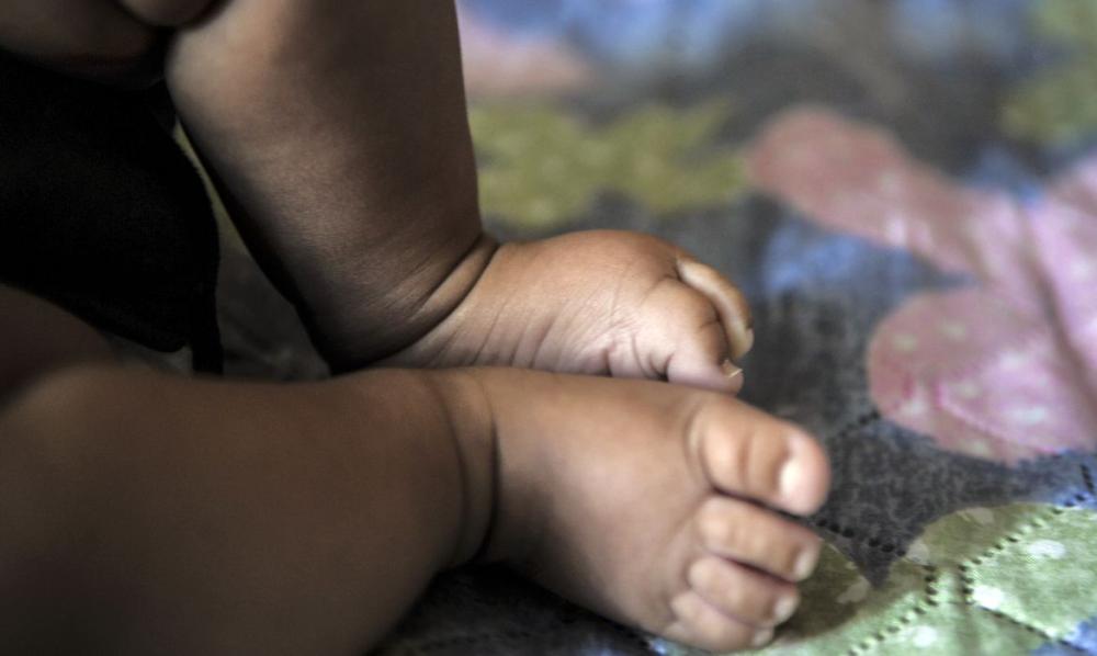Polícia investiga caso de bebê que teve a cabeça arrancada no parto